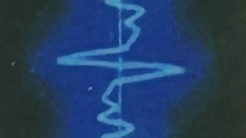 Feierabend w/ Skee Mask