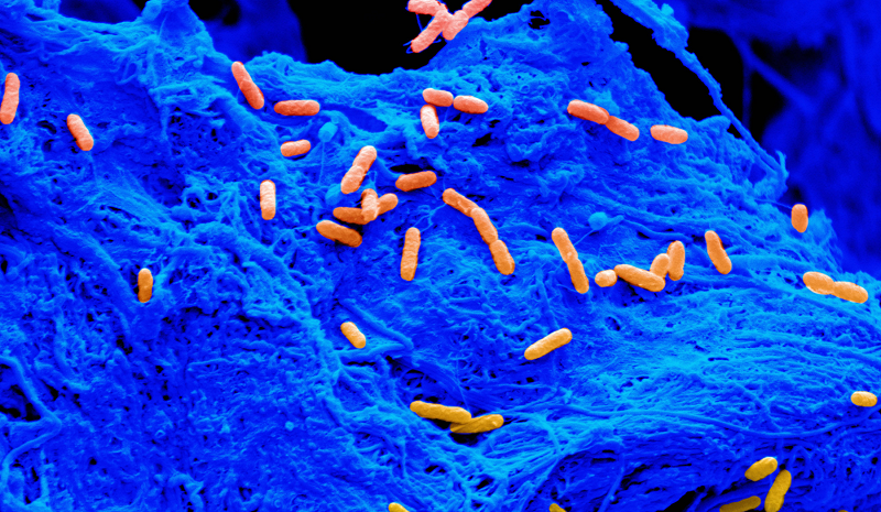 Circle Packing w/ Occo